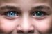 Heterochromia Jenis Keunikan Warna Mata yang Langka