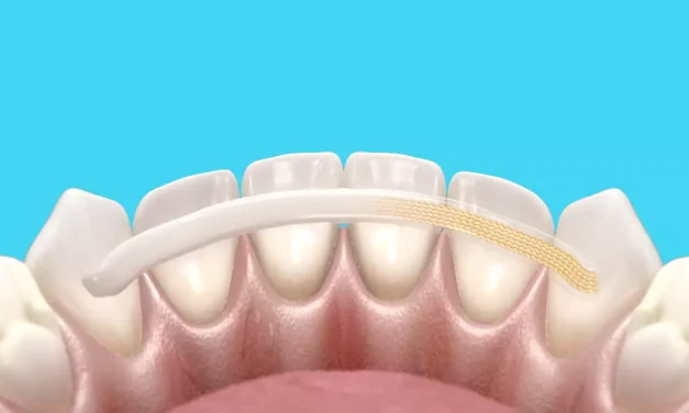 Solusi Jitu Biar Gigi Goyang Gak Jadi Tanggal