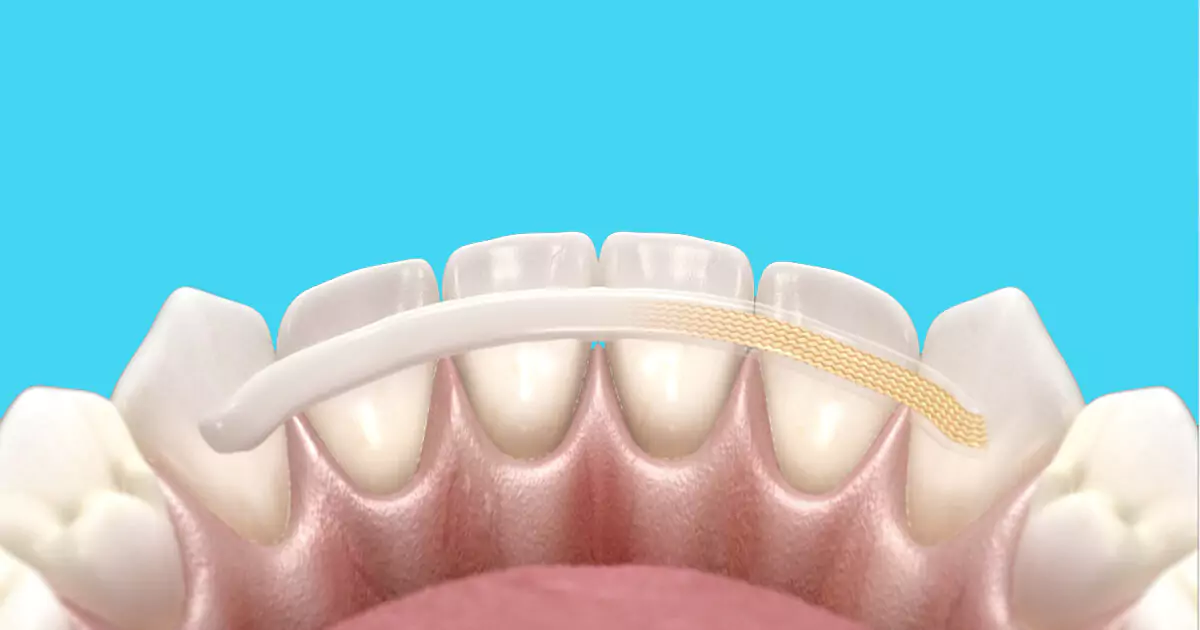 Solusi Jitu Biar Gigi Goyang Gak Jadi Tanggal