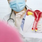 Tiap 25 Menit, Kanker Serviks Merenggut Satu Nyawa
